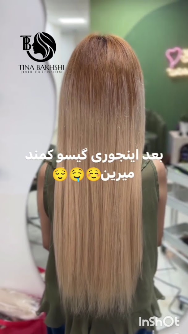 نمونه‌کار مرکز اکستنشن موقت تینا