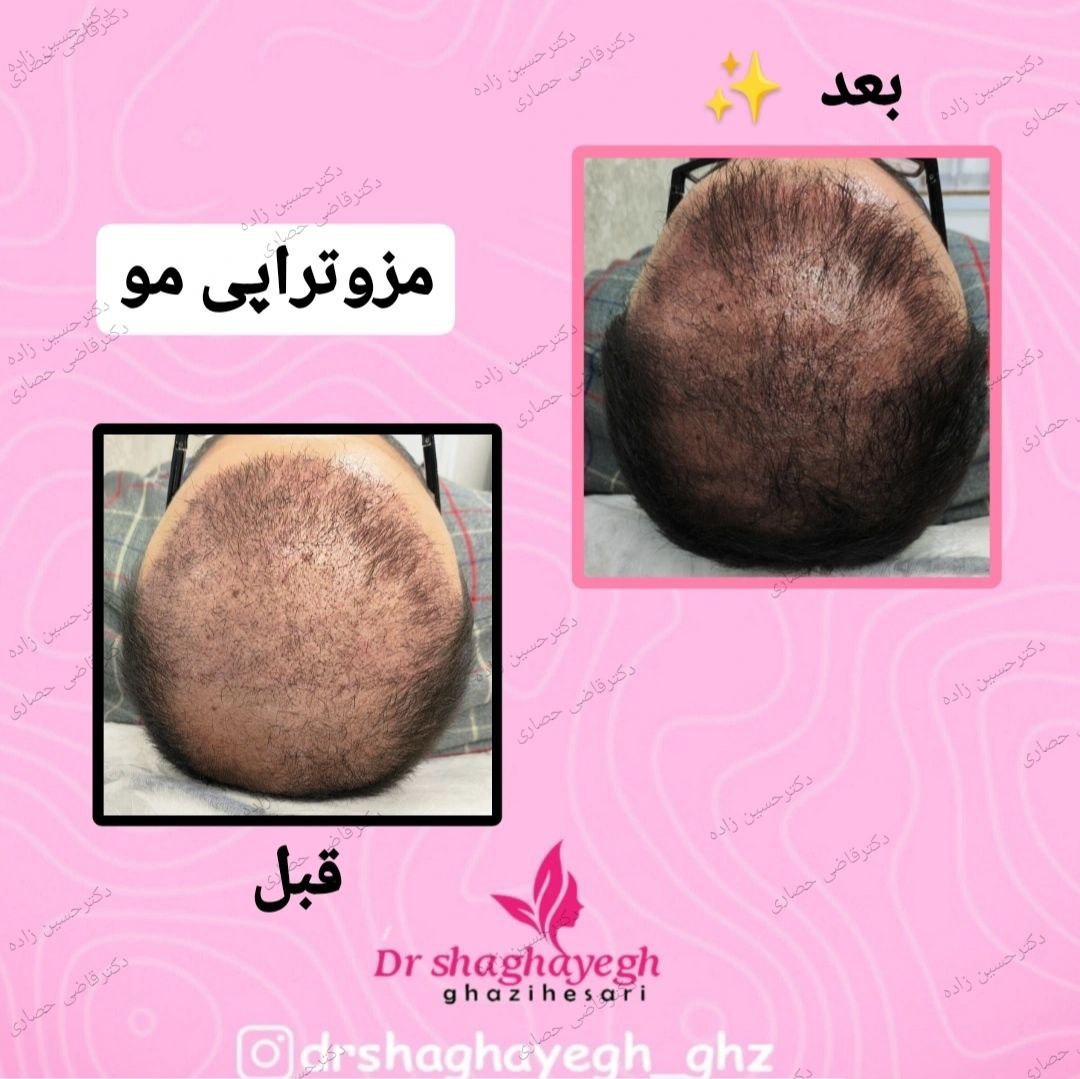 نمونه‌کار کلینیک زیبایی دکتر علی حسین زاده
