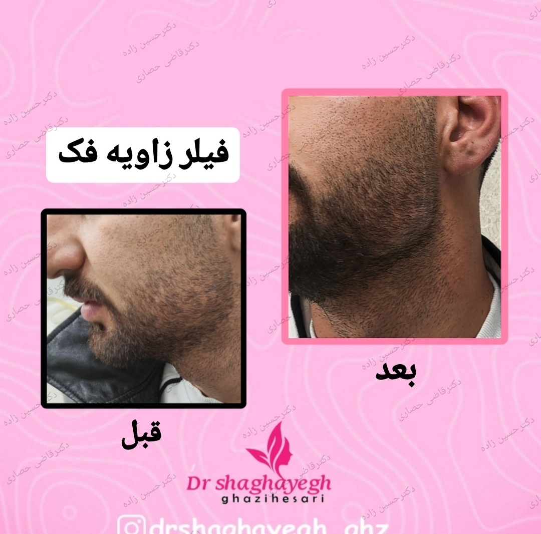 نمونه‌کار کلینیک زیبایی دکتر علی حسین زاده
