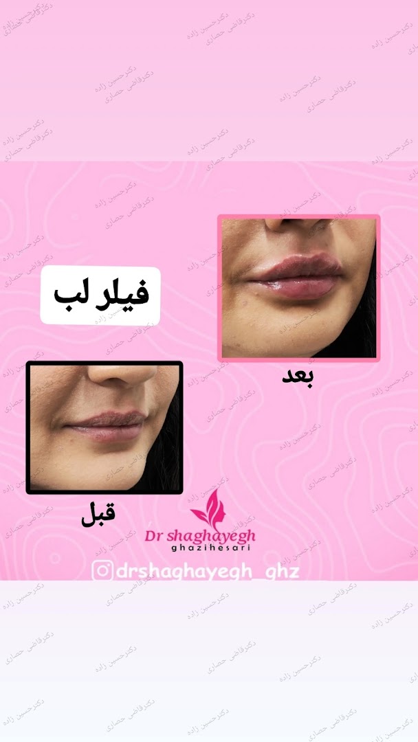 نمونه‌کار کلینیک زیبایی دکتر علی حسین زاده
